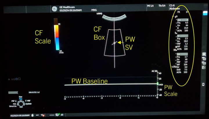 Ultrasound machine with cosmic background Ultrasound machine showing fetal scan with galaxy and Earth in background